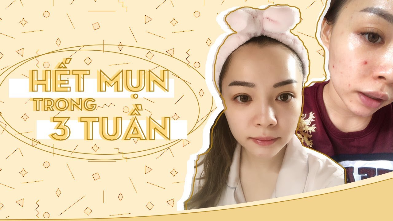 Skincare Buổi Tối Cho Da Mụn ♡ Night Skincare Routine For Acne Prone Skin ♡ TrinhPham