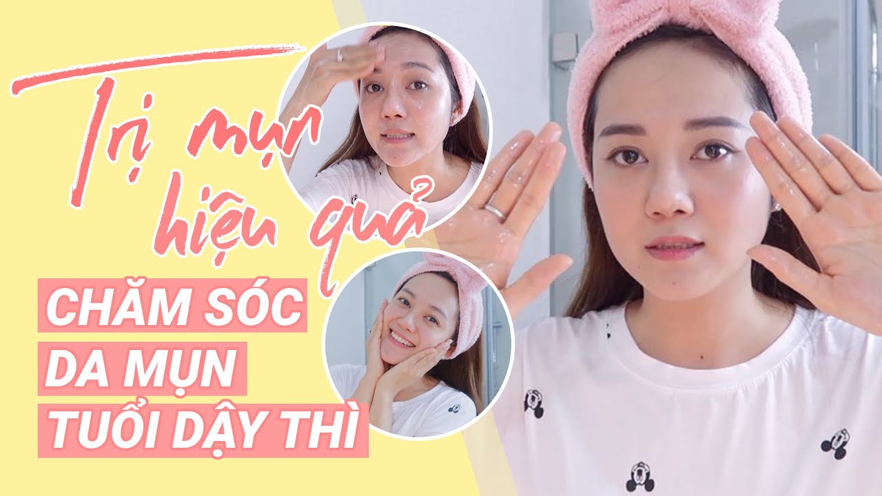 Bước Quan Trọng Nhất Để TRỊ MỤN| Chăm Sóc Da Mụn TUỔI DẬY THÌ An Toàn, Hiệu Quả Tại Nhà!!!👍🏻👍🏻