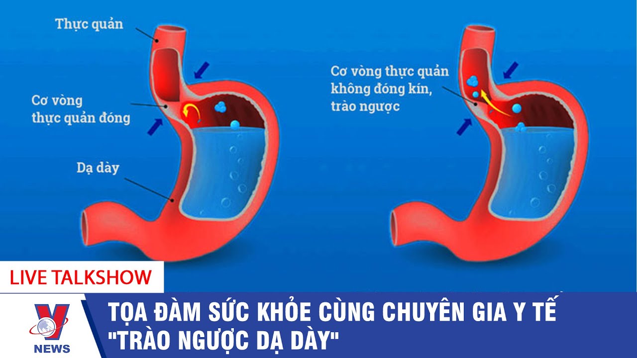 [TRỰC TIẾP] TỌA ĐÀM SỨC KHỎE CÙNG CHUYÊN GIA Y TẾ "TRÀO NGƯỢC DẠ DÀY" – VNEWS