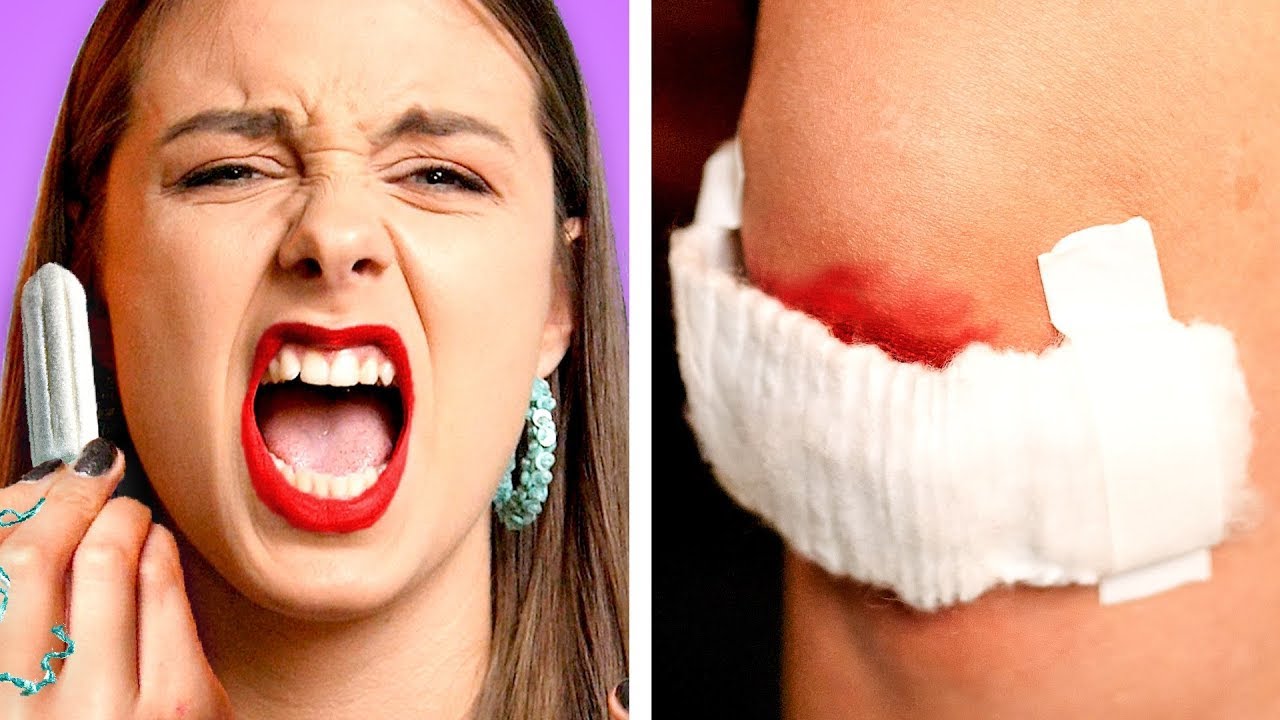 OUCH!! USEFUL FIRST AID HACKS | Lời Khuyên Hay Về Sức Khỏe Và Những Mẹo Sơ Cứu Cực Kỳ Hữu Ích