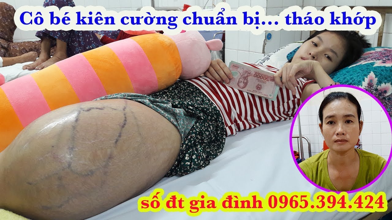 Mới nhất về tình hình sức khoẻ cô bé ung thư xương kiên cường |chuẩn bị tháo khớp – Guufood