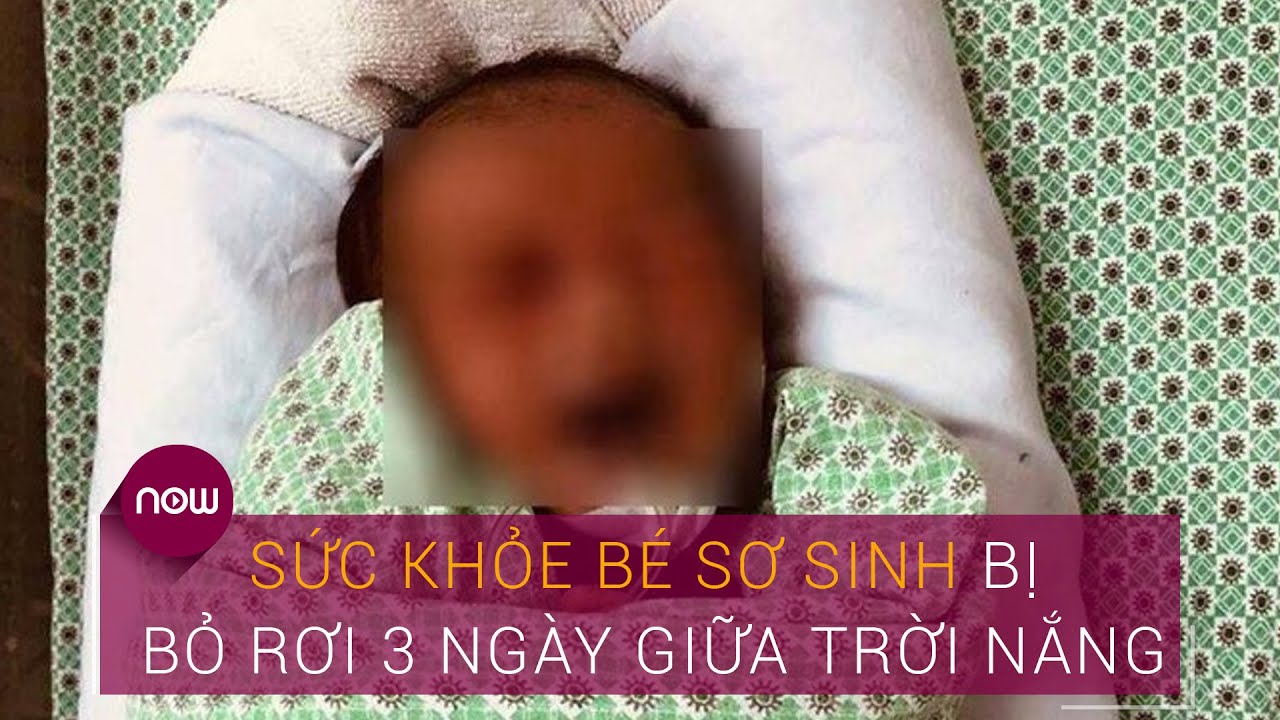 Sức khỏe bé sơ sinh bị bỏ rơi 3 ngày giữa trời nắng | VTC Now