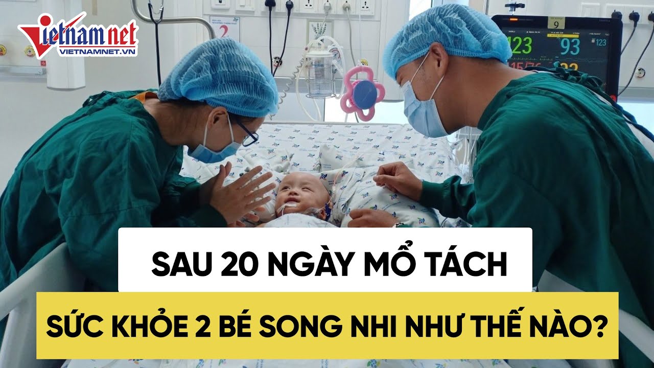 Sức khỏe của 2 bé Trúc Nhi Diệu Nhi như thế nào sau 20 ngày mổ tách? | Tin tức Vietnamnet