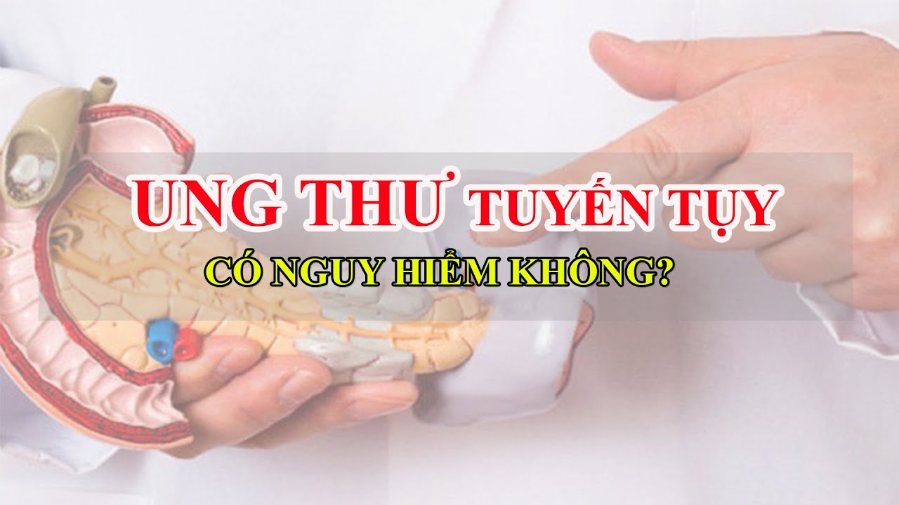 Ung Thư Tuyến Tụy Có Nguy Hiểm Không ? / STM Sức khỏe đời sống