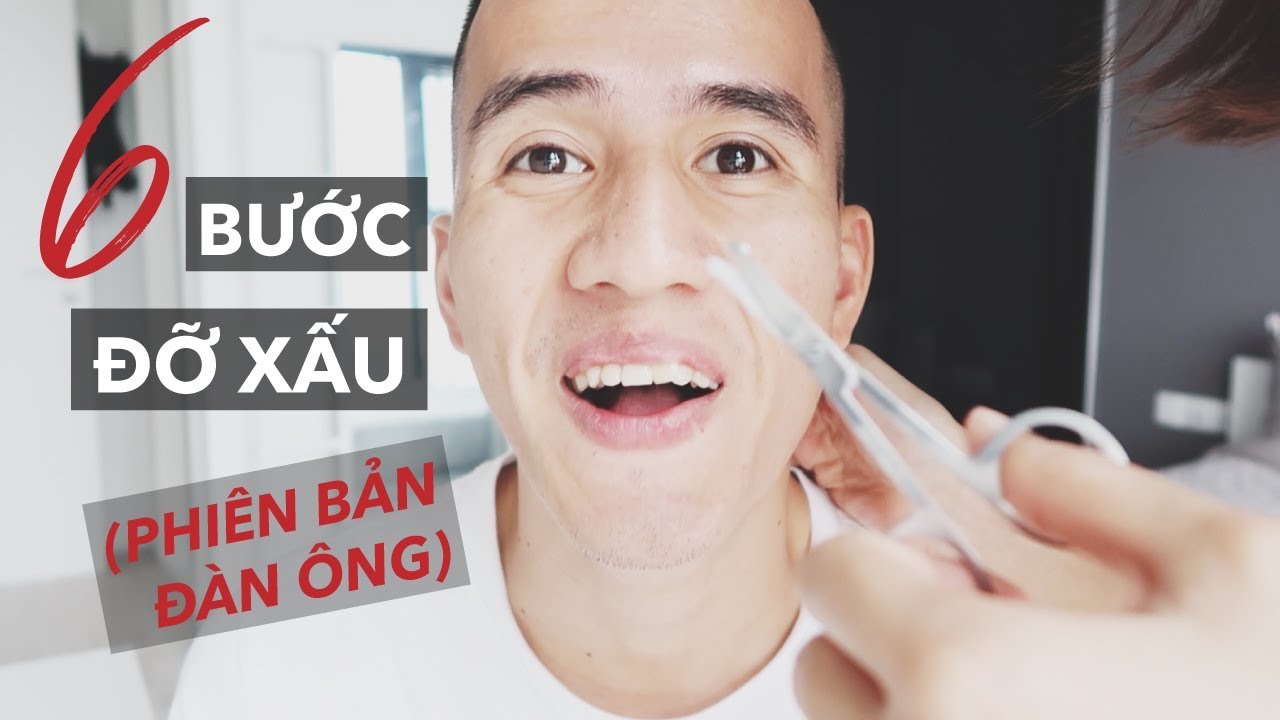 6 bước để hết xấu cho đàn ông