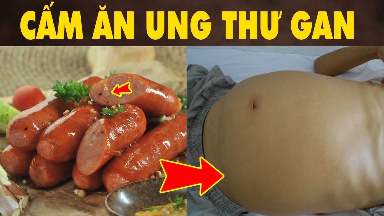 4 Loại Thực Phẩm Càng Ăn Càng Nhanh Ung Thư Gan Muốn Sống Lâu Thì Đừng Ăn | HYT3