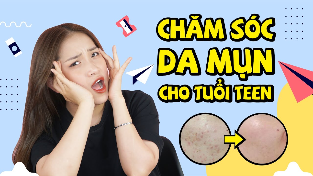 Chăm Sóc Da Mụn Cho Tuổi Teen ♡ Cách Xử Lý Mụn Không Thâm ♡ Skincare Routine For Acne Prone Skin ♡