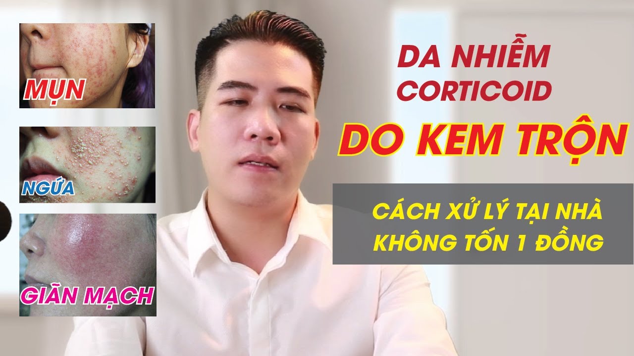 ? Da nhiễm Corticoid do KEM TRỘN – Mụn do DEMODEX – TIẾT LỘ MẸO XỬ LÝ TẠI NHÀ | Thẩm Mỹ Viện Facemax