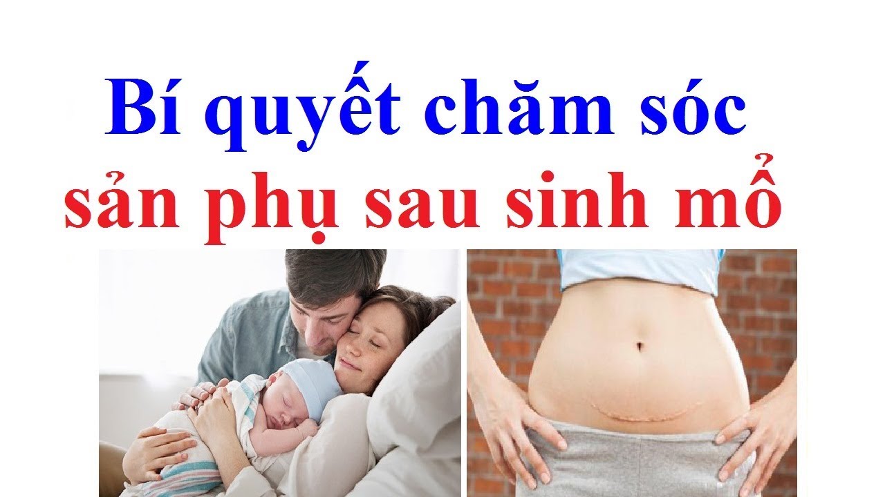 chăm sóc bà bầu đẻ mổ – chăm sóc phụ nữ sau sinh mổ – chăm sóc mẹ và trẻ em