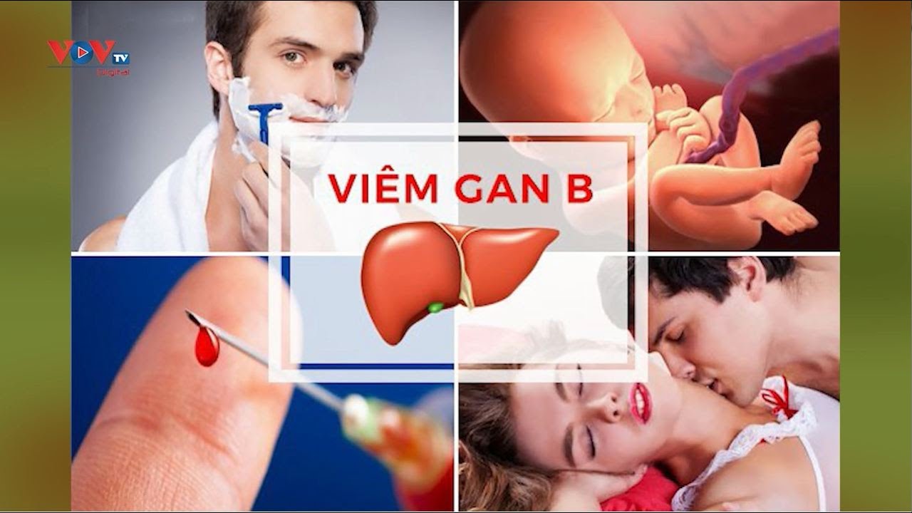 Bệnh viêm gan B và các biện pháp phòng tránh | Sức khỏe là Vàng