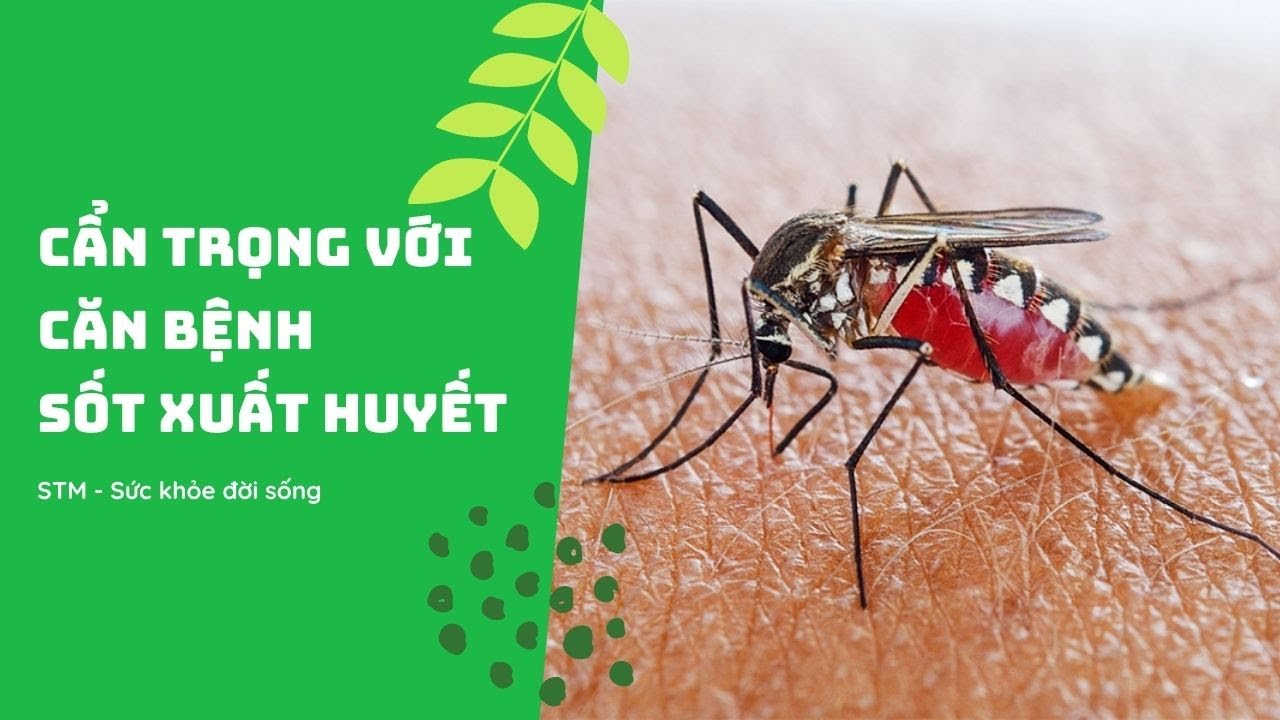 Đừng Chủ Quan Về Sốt Xuất Huyết / STM Sức Khỏe Đời Sống