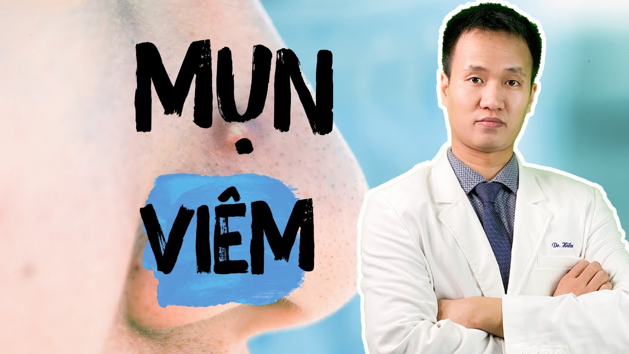 ĐIỀU TRỊ MỤN MỦ – MỤN viêm đừng làm dụng KHÁNG SINH | BPO/T3 mycin…  ? | Dr Hiếu