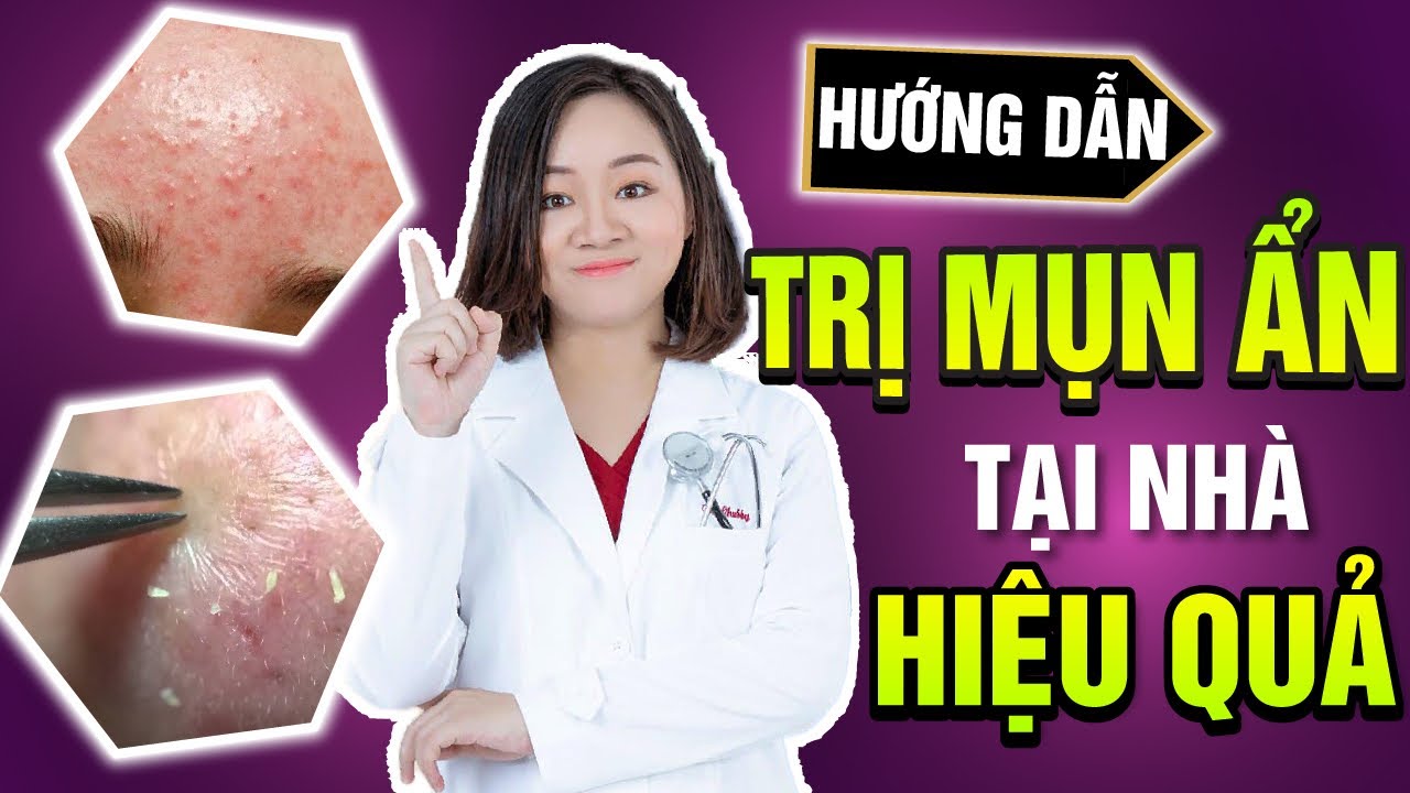 Hướng dẫn TRỊ MỤN ẨN tại nhà với Bác Sĩ Da Liễu